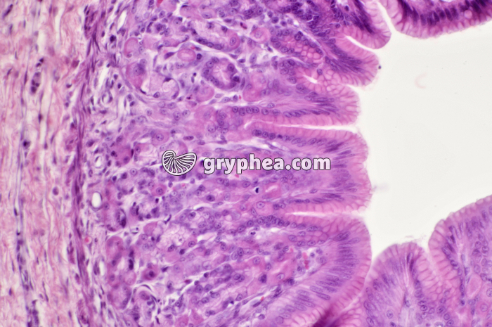 Estomac pylorique x100 - gryphea.org